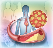 High cholesterol thematic overview