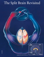 Split brain - a study of isolated cerebral hemispheres
