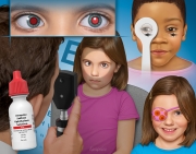 Amblyopia - Detection and Treatment