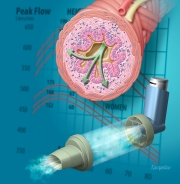 Management of acute asthma exacerbations