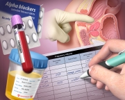 Benign Prostatic Hypertrophy