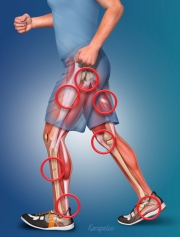Common Running Injuries