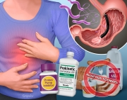 Functional Dyspepsia