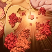 Pituitary Gland and Growth Hormone