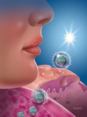 Herpes simplex virus (HSV) and sunlight trigger