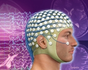 Non-febrile seizures