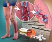 Veno-thrombo-embolism Effects and Medical Management