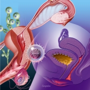 Women's genitourinary problems
