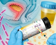 Cystitis in women