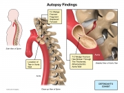 pathological findings of injury