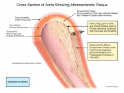 pre-existing pathology predisposing injury