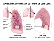 pathology prior to surgery