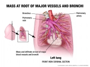 pathology prior to surgery - detail