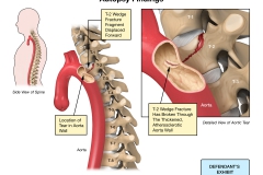 pathological findings of injury pathological findings of injury