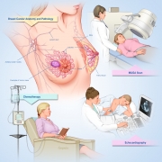 Breast cancer anatomy, imaging and treatment