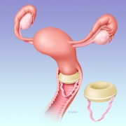 Contraceptive sponge