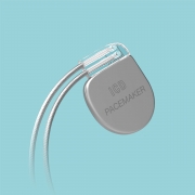 ICD pacemaker