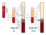 Plasma double-spin titration