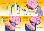 Rofleponide Palmitate Nasal Spray specific formulation advantages
